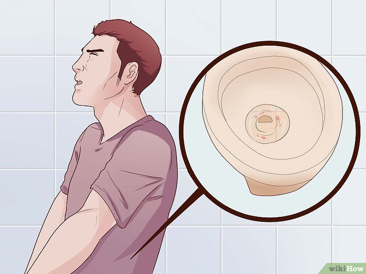 Jual Obat Sipilis De Nature Di Pinrang