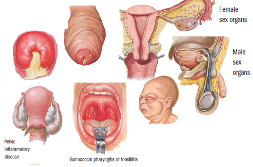 Jual Obat Sipilis De Nature Di Situbondo