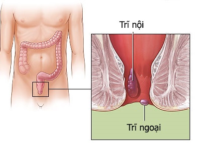 Jual Ambejoss Salep Salwa Obat Wasir De Nature Di Muaro Jambi