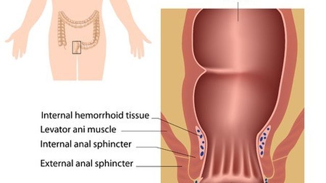 Jual Ambejoss Salep Salwa Obat Wasir De Nature Di Landak
